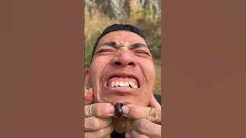 How I Cured a Bug Bite with Yogurt in the Wild | Survival Hacks