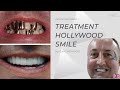 International plus dental l hollywood smile