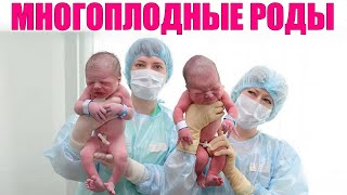 РОЖДЕНИЕ БЛИЗНЕЦОВ | Сильно ли отличаются роды двойни от родов одного ребенка