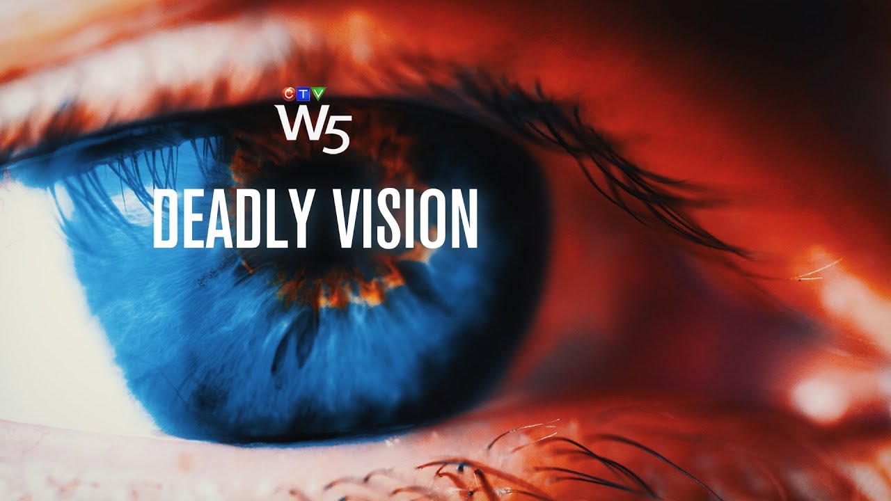 W5: Relentless pain in the pursuit of perfect vision