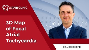3D map of focal Atrial Tachycardia