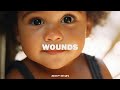 " WOUNDS " Acoustic Guitar Instrumental 2025 (Guitar acoustic Type Beat)