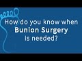When is Bunion Surgery Recommended?