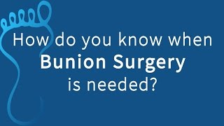 When is Bunion Surgery Recommended?
