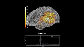 MNE-Python source timeseries