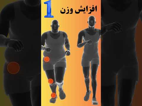 4عامل خطر برای آرتریت که قابل کنترل هستند التهاب مفصل  آرتریت التهاب مفصل دکتر فرزاد