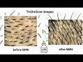 NMN Increased Hair Growth by 57%? (New Human Trial)