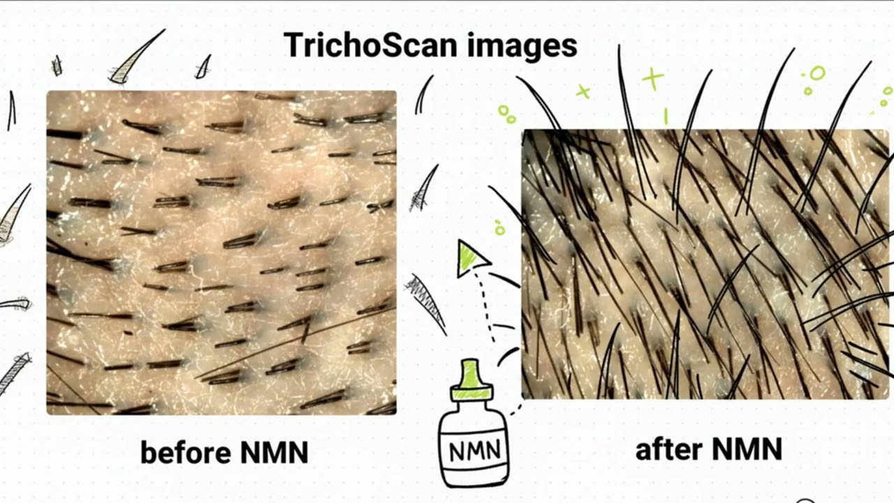 Увеличивает ли NMN рост волос на 57%? (Новые результаты клинических испытаний на людях)
