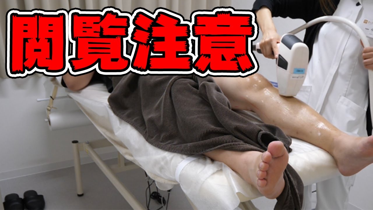 Viewer Discretion Advised] I started getting lower body laser hair