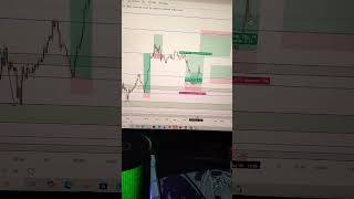 xau #trading #xauusd #xauusdlive