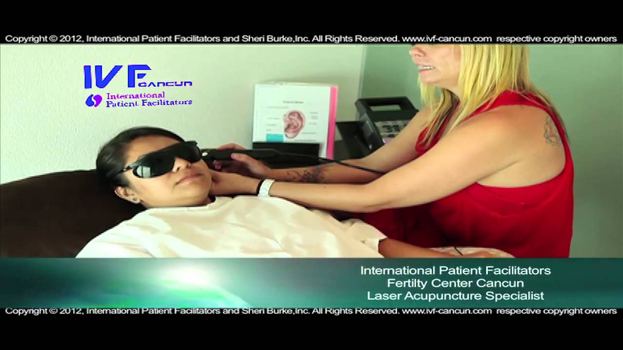 IVF Acupuncture Treatment Cancun Mexico YouTube