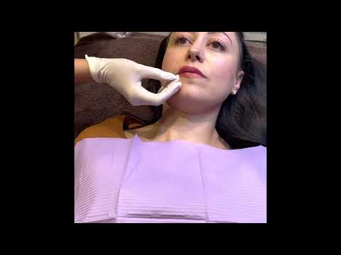 BOTOX & FILLER JAVEA - ZEN CLINIC