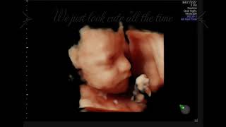 How Incredible is Sneak Peek Ultrasounds Technology