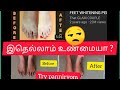 lets try feet whitening home remedies in  tamil | இதெல்லாம் உண்மையா ?