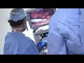 Gastric Sleeve Surgery with Bariatric Surgeon Dr. Philip Swanson