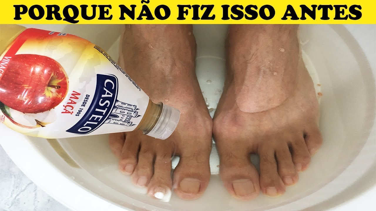 meu-deus-nunca-imaginei-que-colocar-os-p-s-no-vinagre-de-ma-fosse