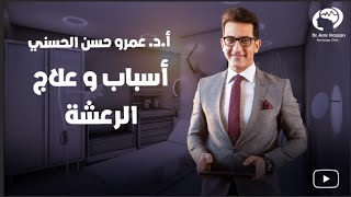 أسباب و علاج الرعشه-أ.د.عمرو حسن الحسني أستاذ المخ والأعصاب