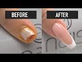 How to repair a broken nail  nails 21