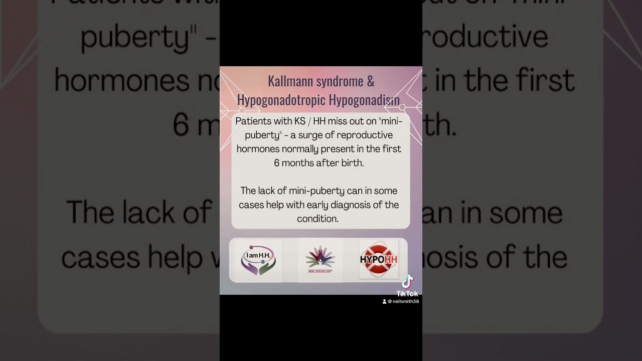 Kallmann syndrome / Hypogonadotropic Hypogonadism. Absent or partial puberty with or without anosmia