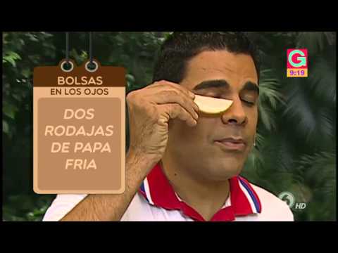 Recetas para aliviar y eliminar las bolsas de los ojos 