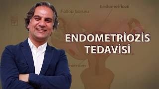 Prof Dr Polat Dursun - Endometri̇ozi̇s Tedavi̇si̇