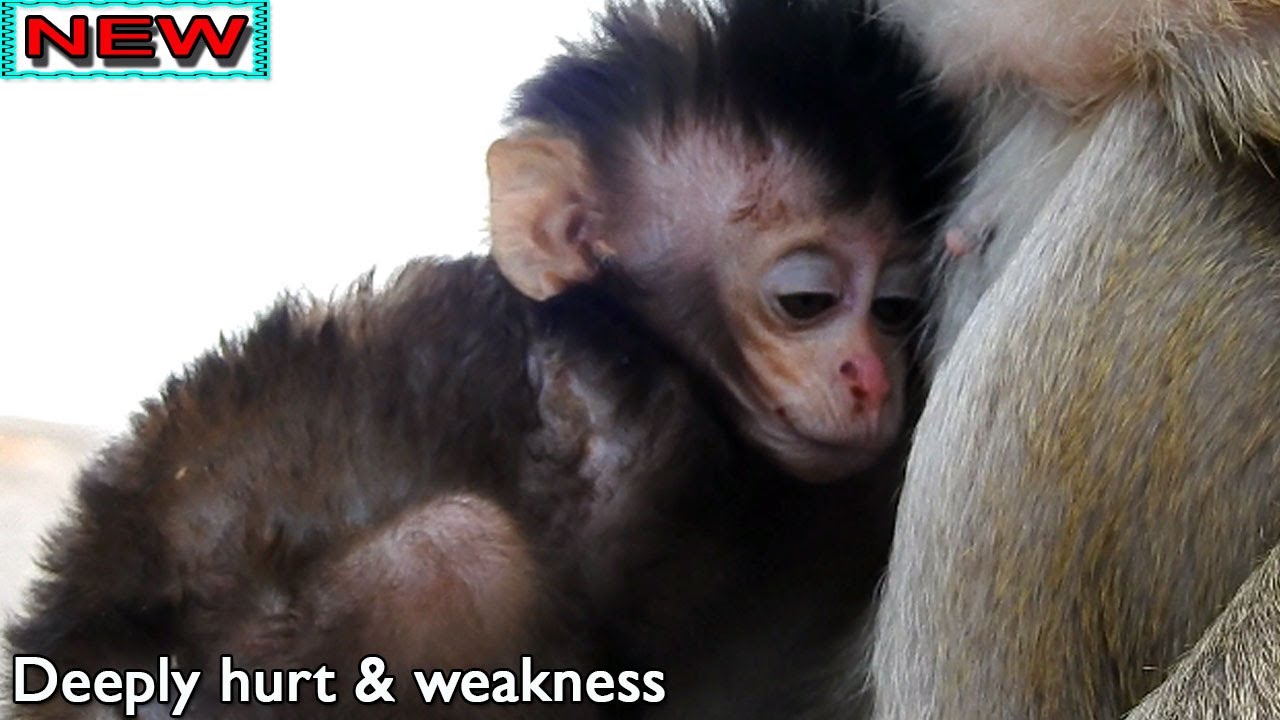 Broken heart! Deep sad of baby Brittany seriously hurt &weakness, Brittany health down cos her pain