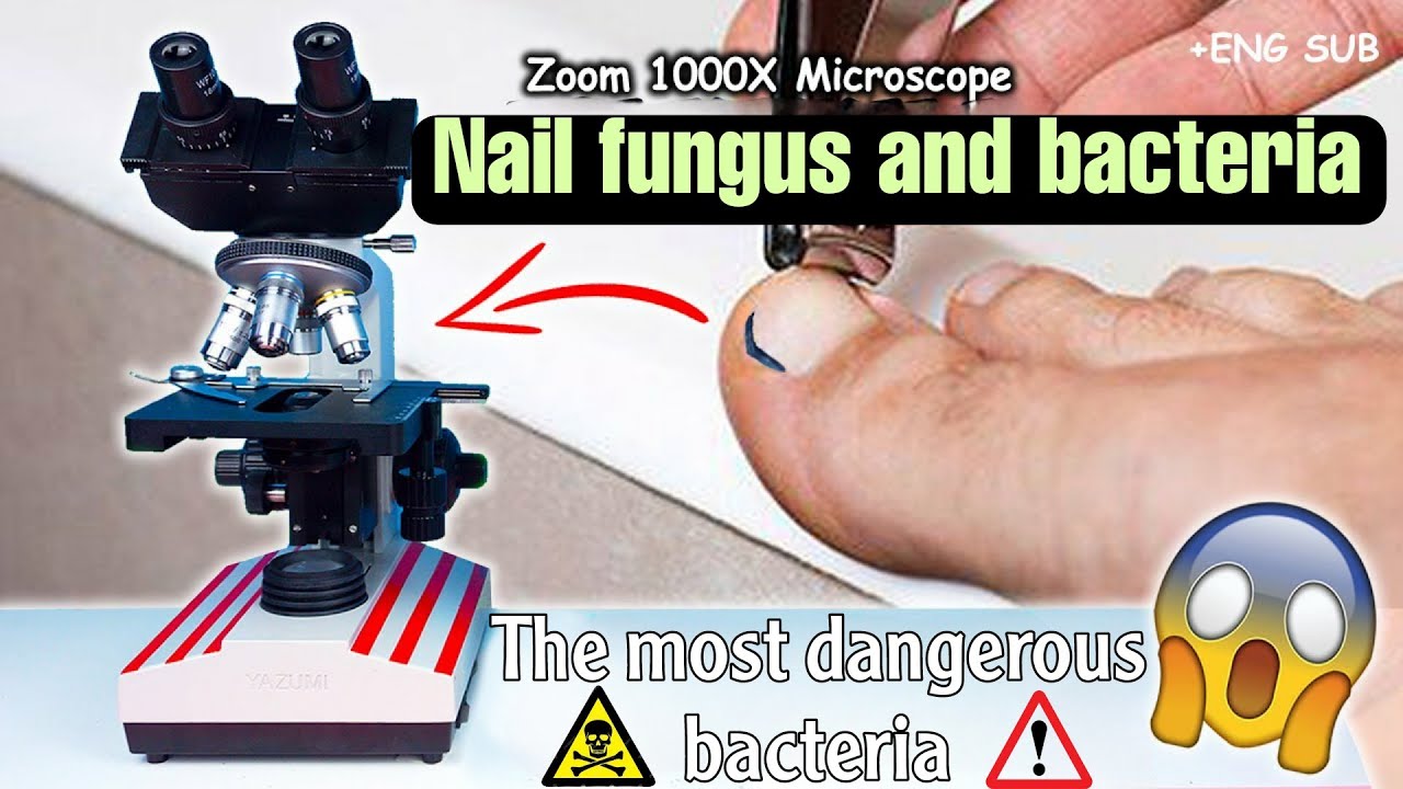 Microscopic View of a Finger Nail | Medical Oddities
