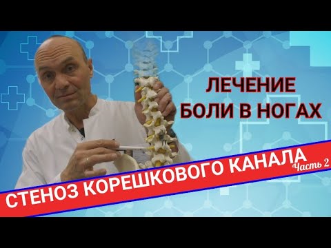 Нарастающая боль при спуске по лестнице в колене. Боль в колене при ходьбе по лестнице: причины, лечение и препараты Боль в колене при ходьбе по лестнице: что делать, если болит сустав при. Боль в колене при ходьбе по лестнице: причины, как лечить