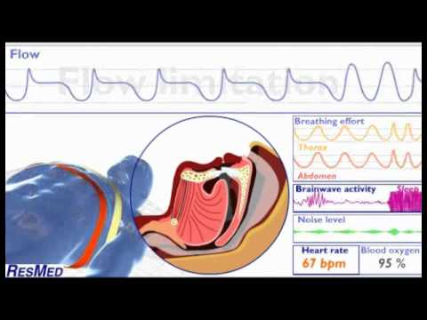 sleep flow breathing understanding limitation