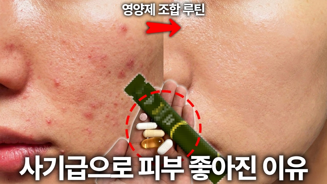 사기급으로 피부 좋아지는 영양제 조합 루틴
