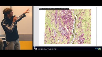 Spatial Patterns of Canopy Structure - UW GIS Day 2015