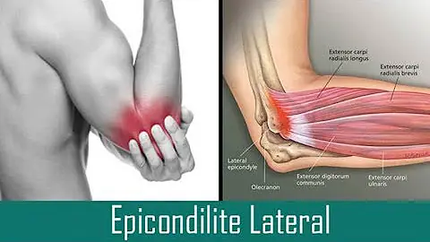 Como imobilizar tendinite no cotovelo?