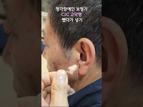 청각장애인 보청기 뺐다가 넣기