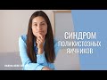 Синдром поликистозных яичников | СПКЯ |  Врач Карина Грек