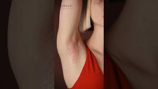 Underarms এর কল দগ কমব কভব I How To Lighten Underarms