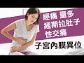 子宮內膜異位症 子宮內膜異位症