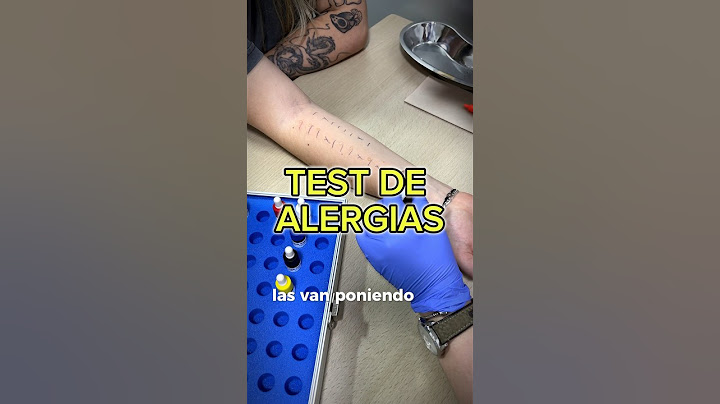 I took the ALLERGY test #asmr #allergy #allergies