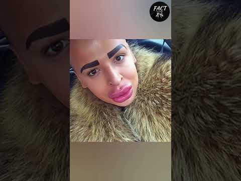 Hot Lips Surgery