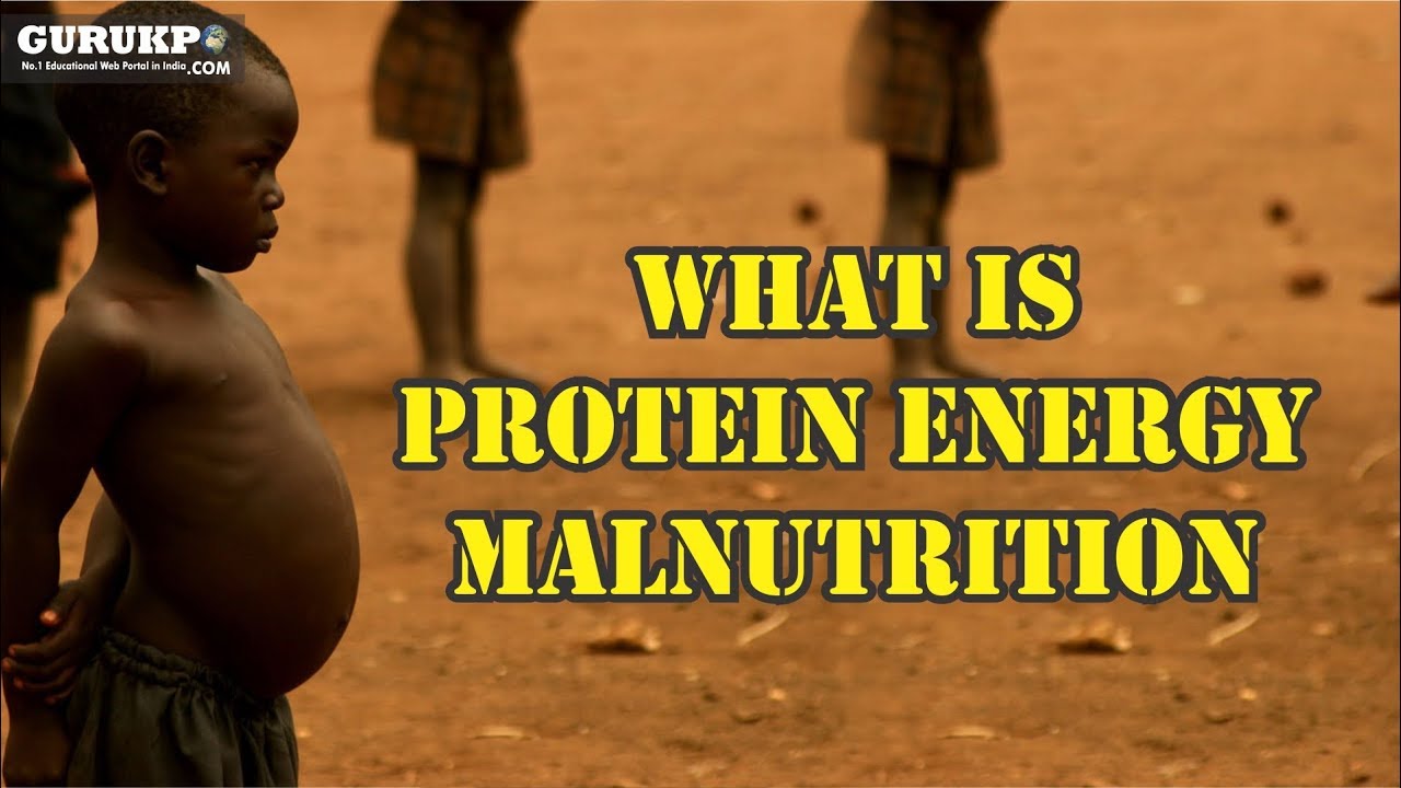 What is Protein Energy Malnutrition, (B.Sc. Nursing) GuruKPO - YouTube