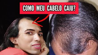 Alopécia androgenética // Como meu cabelo caiu