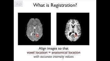 1. Introduction to Brain Extraction and Registration (Reg E1)