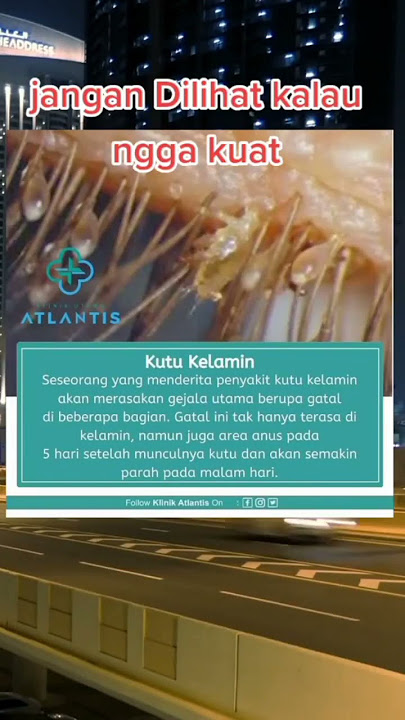 Waspada !!! Kutu Kelamin #shorts