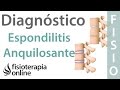 Espondilitis anquilosante - Qué es, diagnóstico y tratamiento