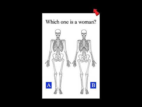 Which One Is a Woman 🤔 Skeleton IQ TestChallenge.