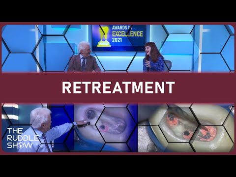 S06 E08 - Nonsurgical Retreatment: Carrier-Based Obturation Removal & MTA vs. Calcium Hydroxide