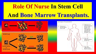 Role of Nurse in Stem Cell and Bone Marrow Transplantation
