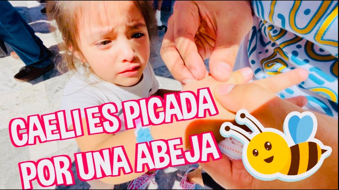 CAELI ES PICADA POR UNA ABEJA / NUESTRO VIAJE A SAN JUAN DE LOS LAGOS