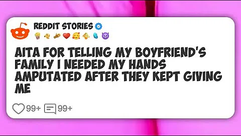 AITA for Telling My Boyfriend’s Family I Needed My Hands Amputated After They Kept Giving #reddit 
