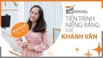 [Tiến trình niềng răng]: #7 Tiến trình niềng răng thay đổi | Khánh Vân