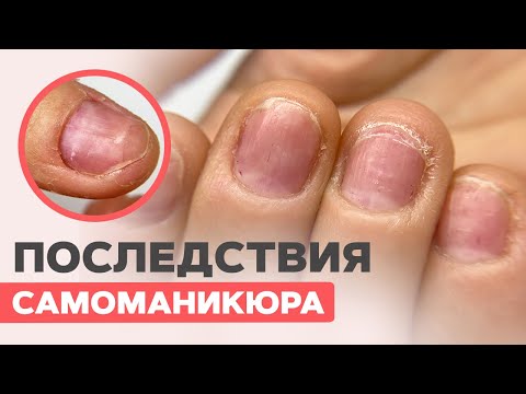 Последствия маникюра САМОЙ СЕБЕ | Укрепление система IBX